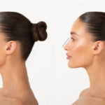Refined Nasal Contouring